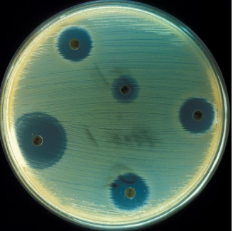 Agarplaat met antibiotica halo's