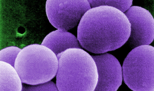MRSA ofwel meticilline-resistente Staphylococcus aureus